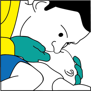 Give 2 quick breaths during CPR for an unresponsive choking infant